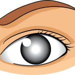 Cataracts